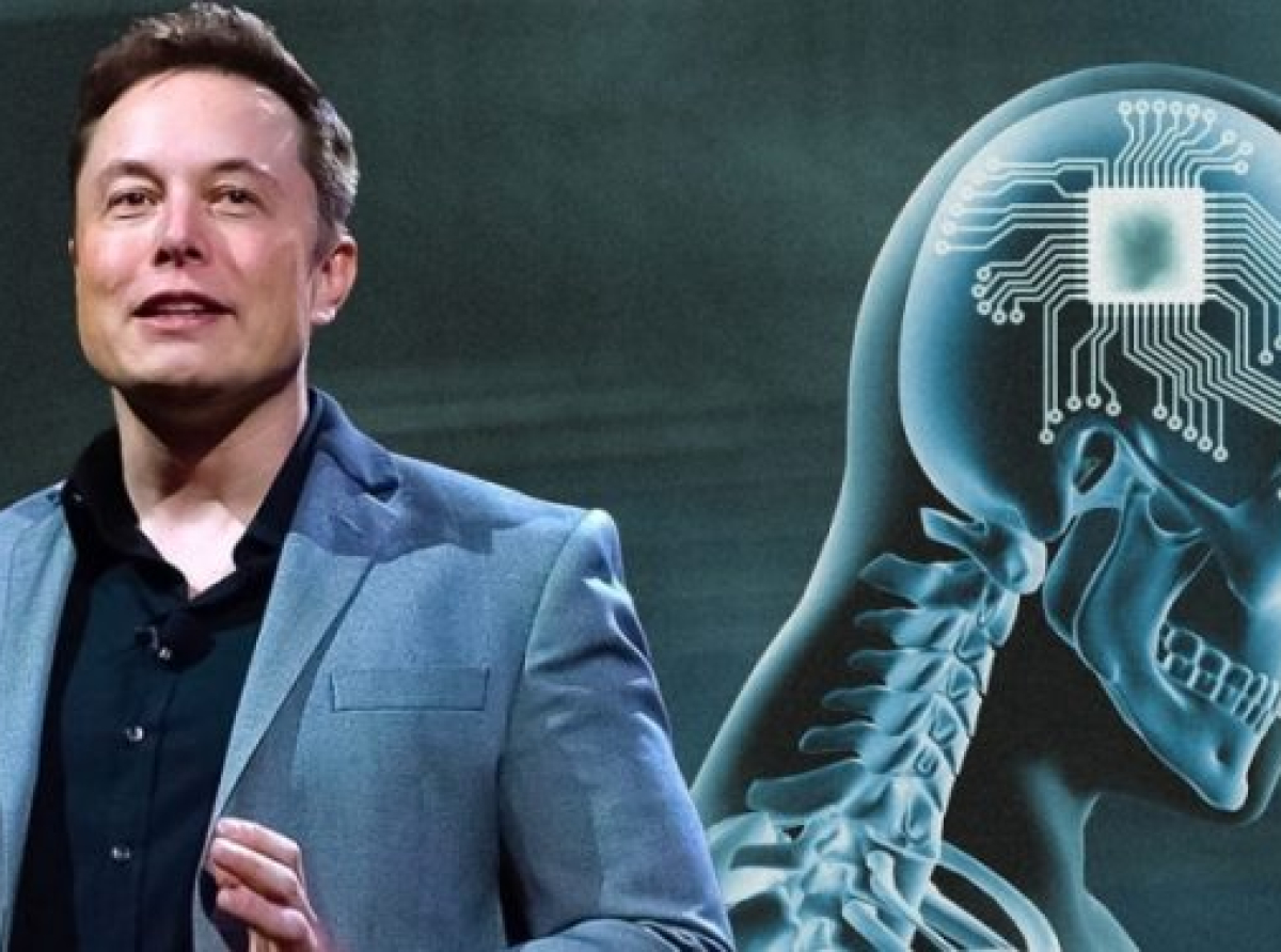 Ο πρώτος άνθρωπος με τσιπ στον εγκέφαλο – Musk: Μπορεί να κινεί ποντίκι με τη σκέψη του